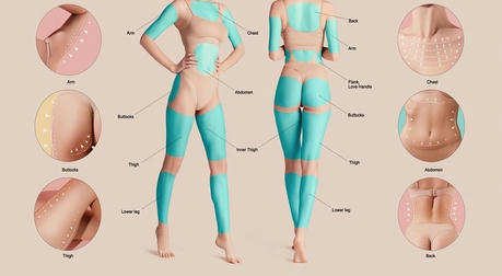 Sculpt Your Body: The Art of Liposuction - Maria S.'s Transformation Journey